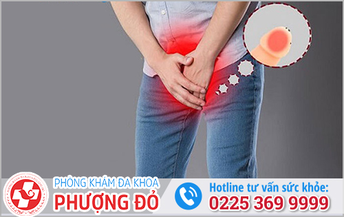 Hậu quả khó lường khi bị viêm bao quy đầu
