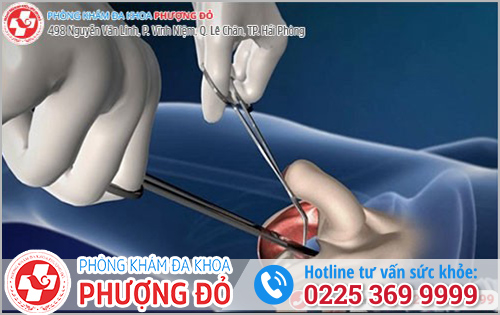 Tăng kích thước dương vật bằng phương pháp an toàn