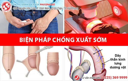 Thế nào là quan hệ nhanh ra? Cách giúp cải thiện thời gian quan hệ