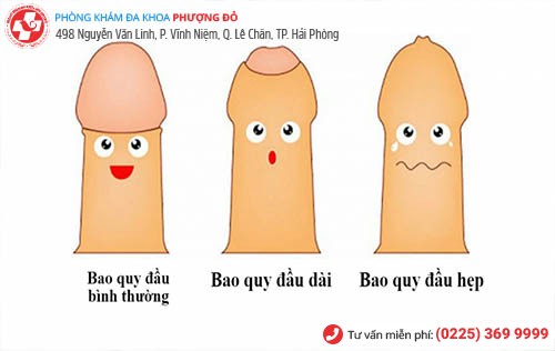 phân biệt dài hẹp bao quy đầu