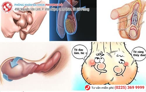  Các bệnh vùng kín ở nam giới không nên bỏ qua