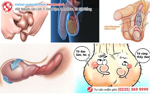 Đến muộn, suýt mất “của quý” vì bệnh dương vật