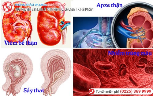 Tác hại khi đường tiểu bị nhiễm trùng