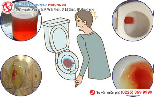 Tiểu ra máu báo hiệu điều gì?