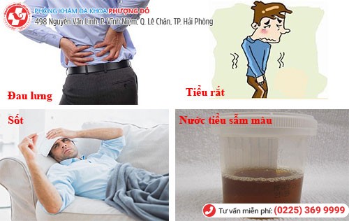 Biểu hiện viêm đường tiết niệu