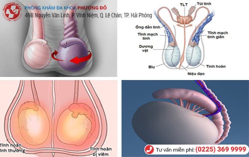 Chữa tinh hoàn bằng cách nào là an toàn?