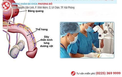 Chặn dây thần kinh lưng dương vật - cách chữa quan hệ nhanh ra hiệu quả