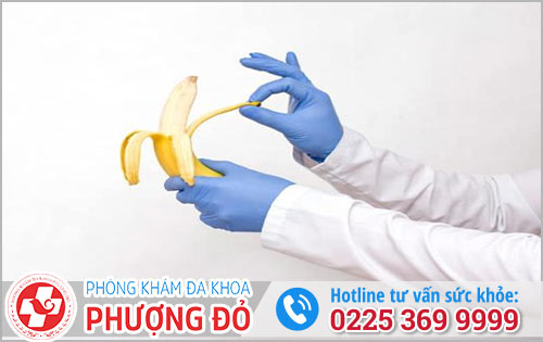 Cách lột bao quy đầu hiệu quả không đau