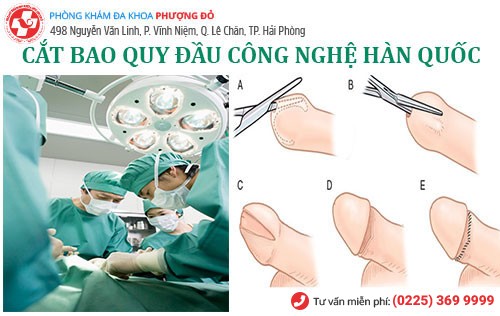 Cắt bao quy đầu công nghệ hàn Quốc - phương pháp chữa bệnh bao quy đầu hiệu quả