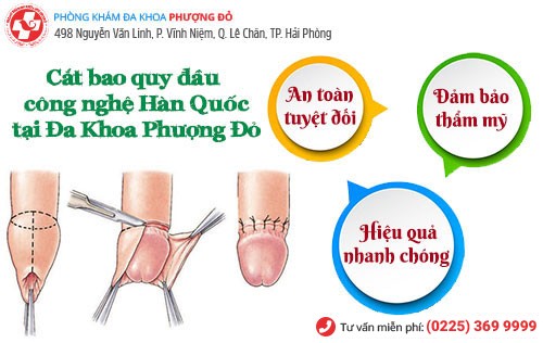 Tiểu phẫu cắt bao quy đầu giúp chữa viêm bao quy đầu hiệu quả