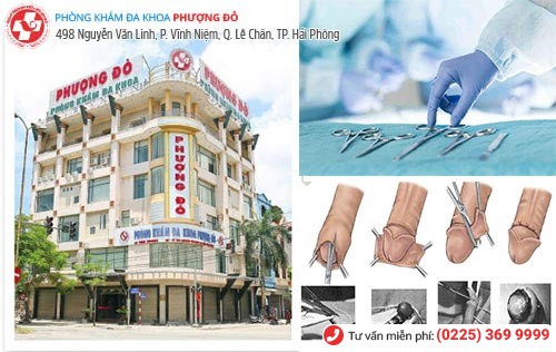 Phòng khám cắt bao quy đầu chuyên nghiệp tại Hải Phòng