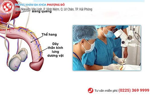 Phương pháp chặn dây thần kinh lưng dương vật