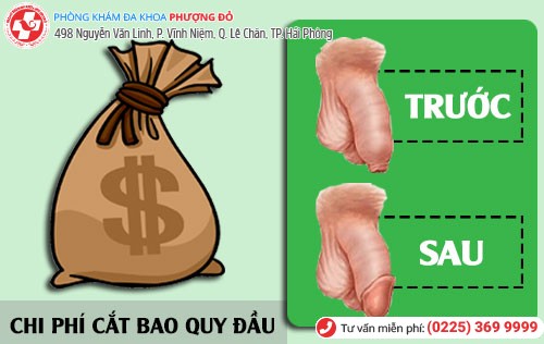 [Công khai] Chi phí cắt bao quy đầu ở bệnh viện Hải Phòng