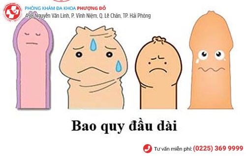 Dài hẹp bao quy đầu dễ dẫn đến hiện tượng nhiễm nấm ở dương vật