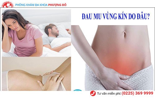 Sỏi bàng quang gây ra những cơn đau mu vùng kín