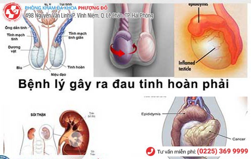 Tôi đối diện với nguy cơ vô sinh do bỏ qua những cơn đau tinh hoàn phải