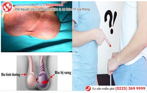 Đau tức bìu không đơn giản là những cơn đau thông thường