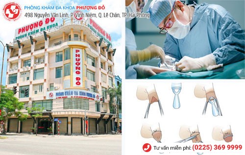 Xâm lấn tối thiểu công nghệ Hàn Quốc - kỹ thuật cắt bao quy đầu tiên tiến nhất hiện nay