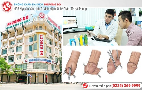  Bệnh nấm dương vật là gì