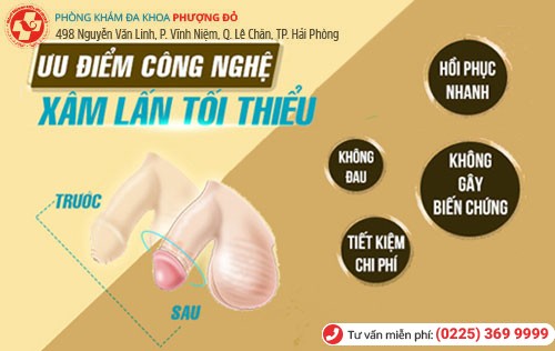 Ưu điểm công nghệ Hàn Quốc trị nghẹt bao quy đầu