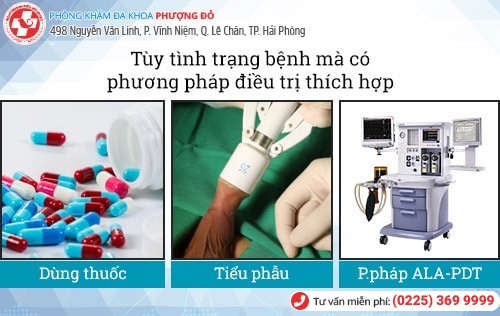 Hình ảnh viêm bao quy đầu. Viêm bao quy đầu có nguy hiểm không?