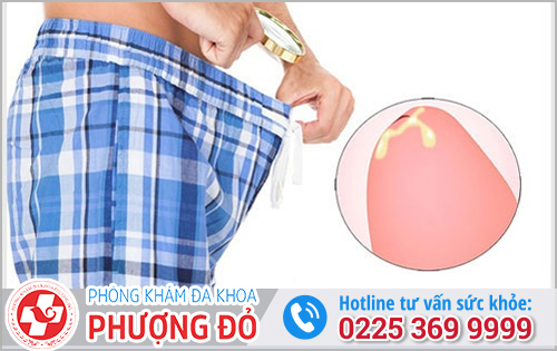 Chảy dịch vàng ở dương vật có nguy hiểm không?