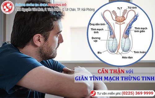 Giãn tĩnh mạch thừng tinh - Cẩn thận nguy cơ vô sinh