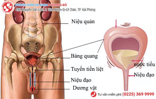 Viêm đường tiểu ở nam