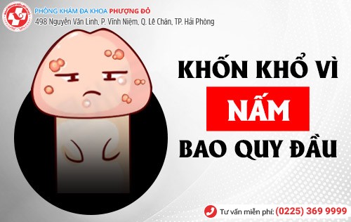 Nấm bao quy đầu – Khốn khổ vì ngứa rát mọi nơi mọi lúc