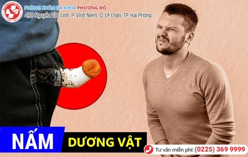 Triệu chứng nấm dương vật và cách trị nấm dương vật