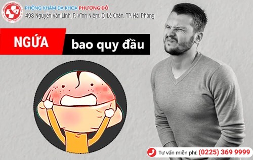 Bi hài chuyện chồng “mượn tạm” dung dịch phụ khoa của vợ vì ngứa bao quy đầu