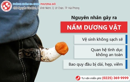 Nấm dương vật ở nam giới nguyên nhân và cách điều trị