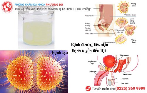 Nước tiểu màu trắng đục