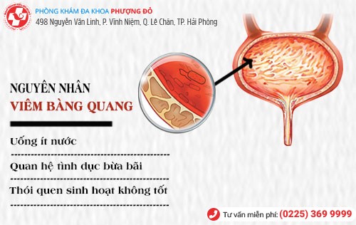 Viêm bàng quang có nguy hiểm không?