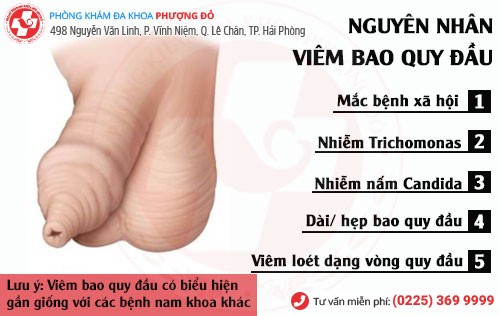 Chủ quan khi bị viêm bao quy đầu và cái kết