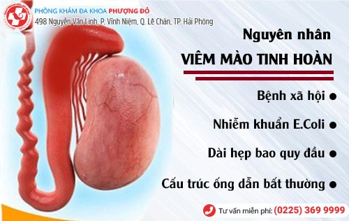 Viêm mào tinh hoàn có lượt tìm kiếm nhiều nhất