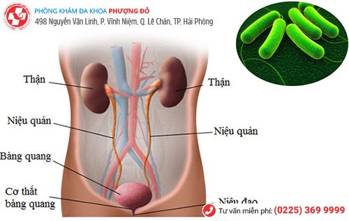 Nhiễm trùng đường tiểu