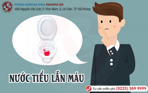 Nguyên nhân nước tiểu lẫn máu và cách điều trị