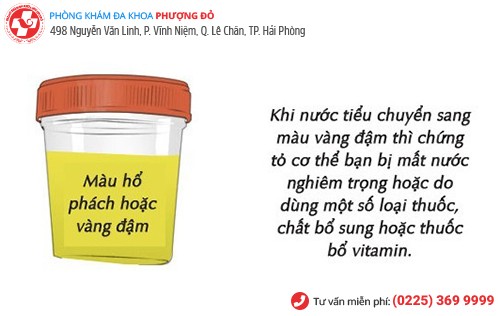 Nước tiểu vàng đậm cảnh báo nguy cơ mắc bệnh gan