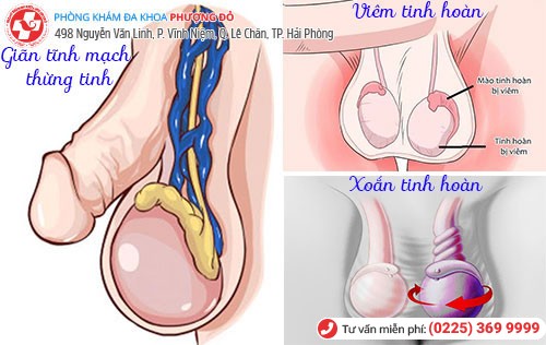 Đối diện với bản án vô sinh do bỏ qua hiện tượng sa tinh hoàn