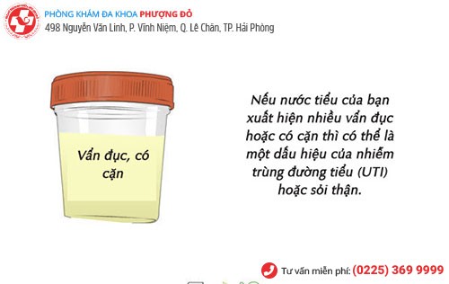 Hình ảnh nước tiểu đục