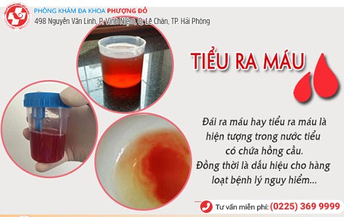 [CẢNH BÁO] Tiểu ra máu là dấu hiệu nhiều bệnh nguy hiểm