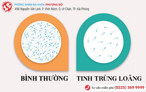 “Bất giác” phát hiện mình bị tinh trùng loãng