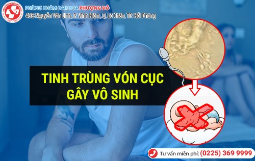 Tinh trùng vón cục cảnh báo vô sinh ở nam