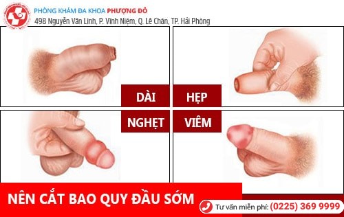 Tại sao phải cắt bao quy đầu?