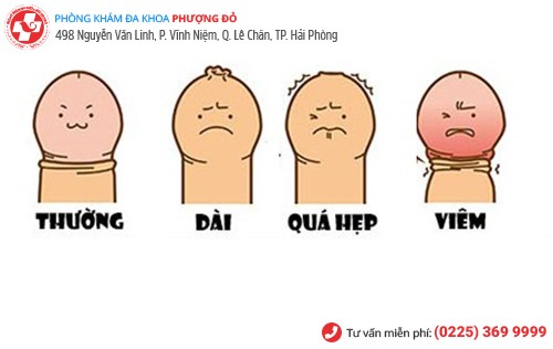 Suýt hoại tử dương vật vì tự tay lộn bao quy đầu tại nhà