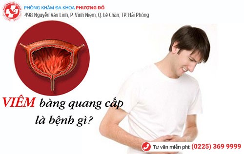 Bệnh viêm bàng quang cấp là gì