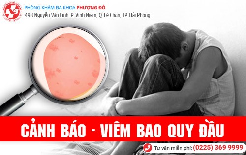 Viêm bao quy đầu có tự khỏi được không?