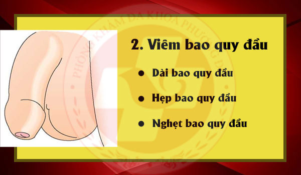 Bệnh viện nam khoa khám viêm bao quy đầu