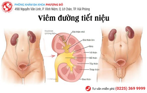 Dấu Hiệu Viêm Đường Tiết Niệu Ở Nam Và Nữ Giới